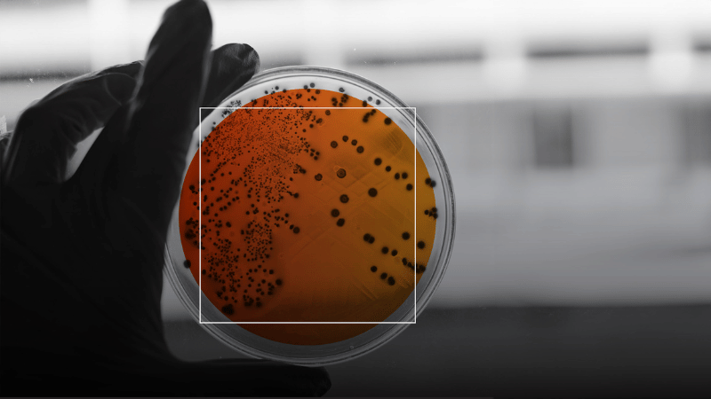 Close-up of a scientist examining a potential anti-microbial strain.